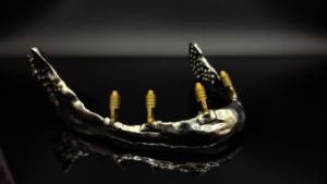 고속 SLM <span class=keywords><strong>3D</strong></span> 치과용 레이저 선택적 용융 <span class=keywords><strong>3D</strong></span> 프린터 산업 - Product Image 4