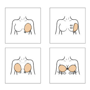 Magic <span class=keywords><strong>Push</strong></span> <span class=keywords><strong>up</strong></span> <span class=keywords><strong>Invisible</strong></span> Silicone Strapless Adhesive Backless Bra para mujer - Product Image 6