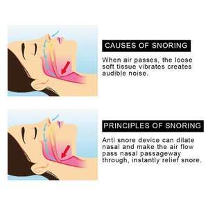 Dispositivi Anti-sbuffamento boccaglio Anti-sbuffamento - Product Image 6