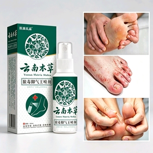 Spray Herbal Yunnan Materia Herb Wolfsbane King, Fragancia Herbal, Antitranspirante, Antifúngico, Antiprurítico, para el Cuidado de Pies con Olor y Hongos - Product Image 1