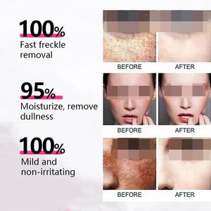 Crème pour le visage à l'alpha-arbutine contre les imperfections, vitamine C, crème anti-taches puissante, crème anti-pigmentation, crème contre les taches de rousseur et la texture de la peau - Product Image 3