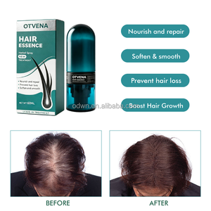 OTVENA Marque Renommée Spray Capillaire Bio à l'Eau de Riz et au Romarin pour la Croissance des Cheveux, Hydratant, Nourrissant le Cuir Chevelu, Réduit la Chute et l'Amincissement des Cheveux - Product Image 2