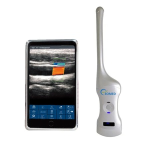 Sonde d'échographie sans fil intelligente à double tête convexe/transvaginale 2-en-1, série à double tête, mini-échographie couleur sans fil DCU19F - Product Image 1