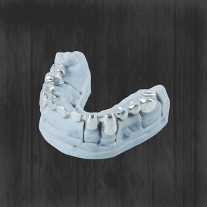 Imprimante 3D métallique SLM pour cadre de <span class=keywords><strong>prothèse</strong></span> <span class=keywords><strong>dentaire</strong></span> complète, équipement de <span class=keywords><strong>prothèse</strong></span> de précision en alliage de titane de qualité médicale - Product Image 4