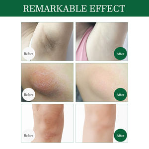 Crème éclaircissante pour les <span class=keywords><strong>aisselles</strong></span> et le corps personnalisée OEM, niacinamide, arbutine, <span class=keywords><strong>eau</strong></span> <span class=keywords><strong>de</strong></span> <span class=keywords><strong>rose</strong></span> pour la correction <span class=keywords><strong>de</strong></span> la pigmentation, hydratante, exfoliante - Product Image 3