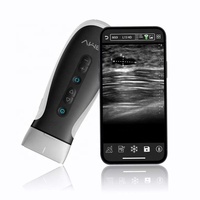 Dispositivo de imagen inteligente lineal cardíaco de matriz en fase Doppler de color de alta calidad 192 elementos WiFi ultrasonido inalámbrico