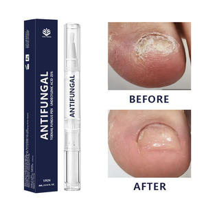 Stylo <span class=keywords><strong>antifongique</strong></span> à l'acide undécénoïque à 25 % pour les infections fongiques des ongles, stylo à huile pour cuticules, accélère la récupération - Product Image 1