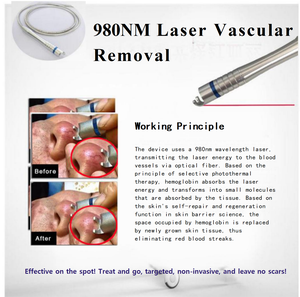 Appareil professionnel de suppression des varices et des vaisseaux sanguins, machine de suppression des varices, traitement vasculaire 980nm médical - Product Image 5