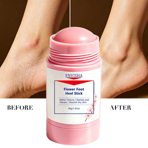 Bálsamo para Pies Anti-Grietas con Logotipo Personalizado, Suavizante de Callosidades, Elimina la Piel Seca y Agrietada, Repara los Talones, Stick Floral para <span class=keywords><strong>el</strong></span> Cuidado de los Pies - Product Image 2