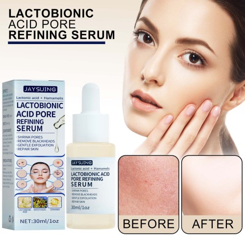 Jaysuing Lactose Solution Exfoliate Remove Blackheads Shrink Pores Clean And Moisturize SkinEssence