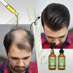 Marque privée 100% Huile de romarin biologique pour la croissance des cheveux Elixirs nourrissants pour le cuir chevelu Soin des cheveux Traitement de la perte de cheveux Huile