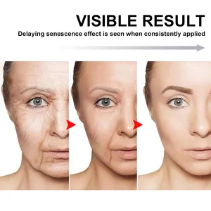 100% produtos do oem natural ajuda a reduzir as rugas linhas seca pele hialurônico ácido hidratante facial creme anti-envelhecimento do rosto