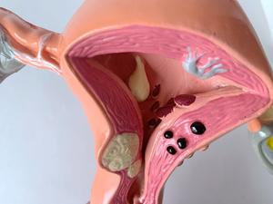 Modèle anatomique de l'utérus <span class=keywords><strong>humain</strong></span> en PVC de haute qualité, structure pathologique gynécologique, organes reproducteurs féminins pour l'enseignement CE/ISO - Product Image 4