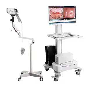 Digital Colposcope Vagina Exam Gynecology Colposcope with CCD Camera CE