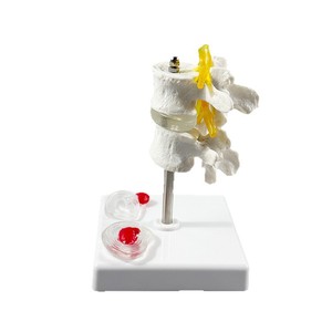 Model Tulang Belakang Manusia Dua Bagian dengan Diskus Intervertebralis untuk Demonstrasi Patologi, Harga Pabrik - Product Image 2