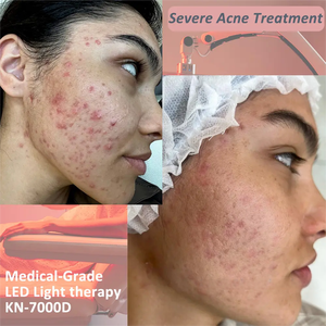 การรักษาด้วยแสงสีแดงเกรดทางการแพทย์ที่ดี<span class=keywords><strong>ที่</strong></span>สุดที่บ้าน CE (EU) 510K(USA) เคลียร์ MD PDT LED - Product Image 5