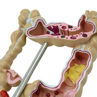 Modelo de Simulación Médica DARHMMY del Colon y Intestino Grueso Humano