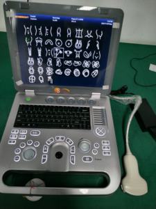 Ecógrafo 3D basado en PC con impresora láser, impresora térmica portátil - Product Image 3