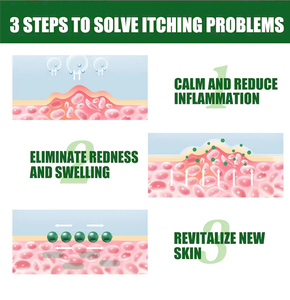 Salep gatal kulit Pruritus, <span class=keywords><strong>Psoriasis</strong></span> Dermatitis Eczematoin kualitas tinggi - Product Image 4