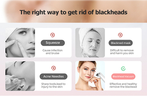 Bigsmile bán chạy nhất mụn trứng cá mặt loại bỏ mụn đầu đen lỗ chân lông chân không loại bỏ mụn đầu đen chân không - Product Image 3