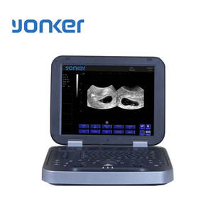 Ecógrafo Veterinario Portátil Doppler a Color para Hospitales de Animales Pequeños - Product Image 3