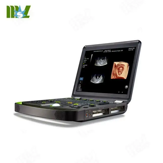 Same as Mindray M9 !!! MSLCU56 excellent image portable laptop color doppler 3D/4D ultrasound machine price