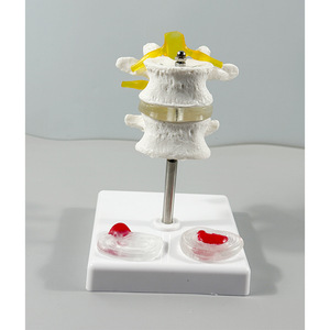 Model Tulang Belakang Manusia Dua Bagian dengan Diskus Intervertebralis untuk Demonstrasi Patologi, Harga Pabrik - Product Image 4