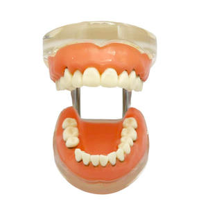 Parodontitis Model Medische Wetenschap Tandheelkundig Model Voor Opleiding In Scholen En Ziekenhuizen - Product Image 1