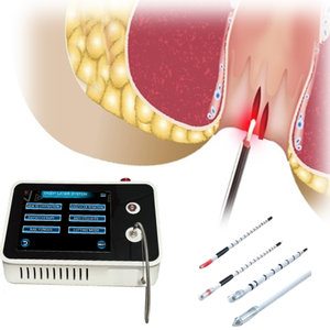 Nuevo Láser de Diodo para Fístula Anal y Hemorroides 1470nm 980nm <span class=keywords><strong>Medicina</strong></span> para Hemorroides Tratamiento de Hemorroides Láser de Proctología - Product Image 1