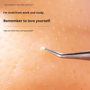 Giocattolo Antistress Realistico per Spremere Brufoli, Modello Testa Grande, Estrattore di Acne, Spingi-Punti Neri, in Plastica, per Ansia e Depressione - Product Image 4