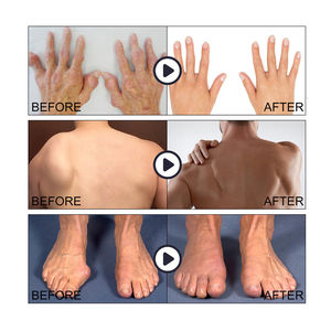 EELHOE pescoço mão cotovelo joelho cintura pé músculo articular dor aliviando gel artrite tratamento articulação osso reparação gel calmante - Product Image 2