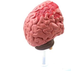 Modelo de Patología Cerebral de PVC Reutilizable, Modelo de Demostración de Anatomía de Hemorragia Cerebral y Malformación Arteriovenosa, Certificado CE/ISO - Product Image 2
