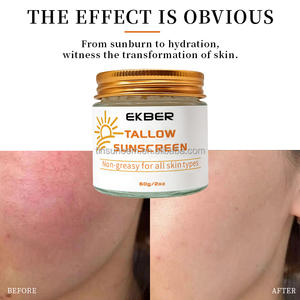 Crème solaire nourrissante EKBER personnalisée aux ingrédients naturels (huile d'olive, miel, suif de bœuf) pour prévenir les coups de soleil et les rougeurs - Product Image 5