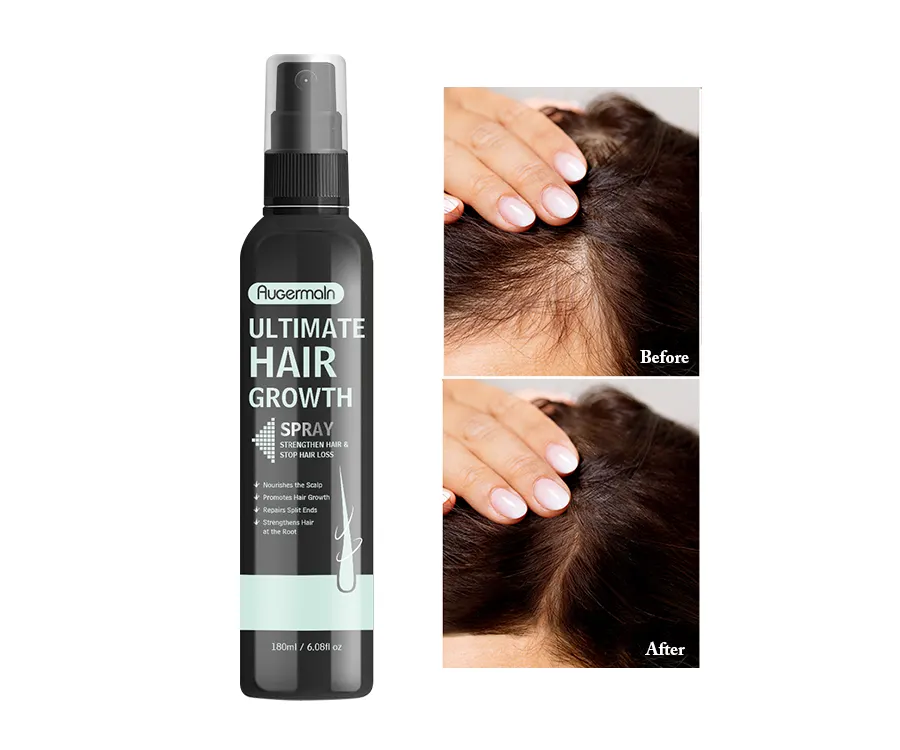 Natuurlijke Organische Haaruitval Behandeling Reparatie Serum Voor Haargroei Veganische Haargroei Spray Olie Voor Zwart Private Label