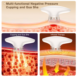 Masseur corporel sans fil Yanxer <span class=keywords><strong>Factory</strong></span> pour le remodelage corporel, le massage à pression négative, la combustion des graisses et la lutte contre la <span class=keywords><strong>cellulite</strong></span>, personnalisation OEM/ODM - Product Image 4
