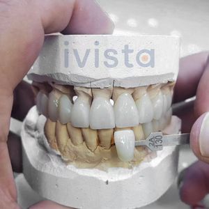 Sıcak Fırsat IVISTA 3D-ML Diş Kaplamaları Takma Dişler Zirkonyum Blok Diş Laboratuvarı İçin Makine - Product Image 3