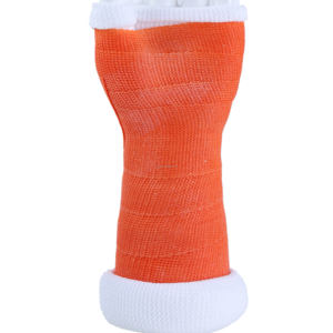 Kostenloses Muster medizinischer Klinik-Verbrauchsmaterial Lieferant Fraktur-Post-Op-Fiberglas-Platte von Pariser Tonablage - Product Image 1