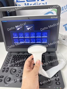 Ecógrafo Veterinario Portátil Sonoscape E2 ProV con Doppler Color para Diagnóstico de Gestación Animal, Escaneo Abdominal y MSK - Product Image 6