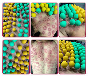 Çok fonksiyonlu akupunktur <span class=keywords><strong>Acupressure</strong></span> manyetik Anti selülit vakum Guasha çukurluğu fincan seti - Product Image 6