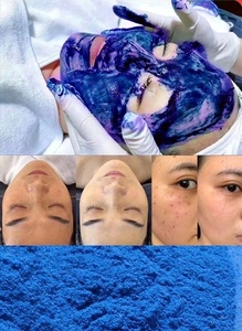 Poudre d'épluchage d'algues naturelles en gros bon marché Bio <span class=keywords><strong>Microneeding</strong></span> Blue Herbal Peel Tool pour la beauté Produit de soins personnels 100 paires - Product Image 2