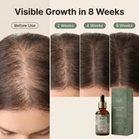 Sérum Anti-Chute de Cheveux 3% Redensyl Biotine Traitement Croissance Capillaire Huile de Repousse Rapide Soin du Cuir Chevelu OEM Marque Privée Vente en Gros Kit 30ml