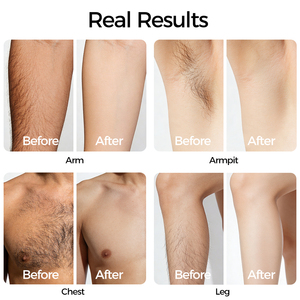 Épilateur laser IPL portable pour femme, vente en gros OEM, pour usage domestique, épilateur manuel pour le corps et le visage. - Product Image 4