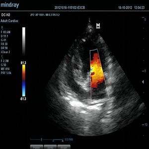 Ecógrafo Veterinario Portátil DC-N3VET de Buen <span class=keywords><strong>Precio</strong></span> para Diagnóstico de Gestación Animal - Product Image 3