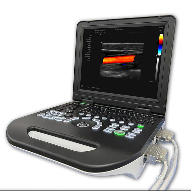 Portable Veterinary Ultrasound Machine Scanner Laptop Vet Monitoring Device for Animal Care