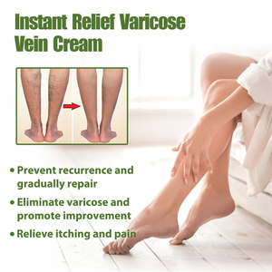 South Moon <strong>Best</strong> Instant Relief <strong>Varicose</strong> <strong>Vein</strong> <strong>Cream</strong> Soreness Swelling Earthworm Leg Relieving Spider <strong>Vein</strong> Removal <strong>Cream</strong> - Product Image 2
