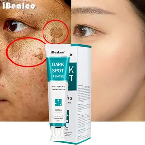 Crème anti-taches pigmentées acné visage, marque privée, blanchissante de jour et de nuit, pour une meilleure élimination des taches de rousseur