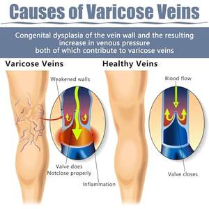Parche de yeso chino de araña para reparación de venas varicosas y mejora de <span class=keywords><strong>la</strong></span> circulación sanguínea, alivio del dolor de <span class=keywords><strong>la</strong></span> vena de <span class=keywords><strong>la</strong></span> pierna de lombriz - Product Image 5