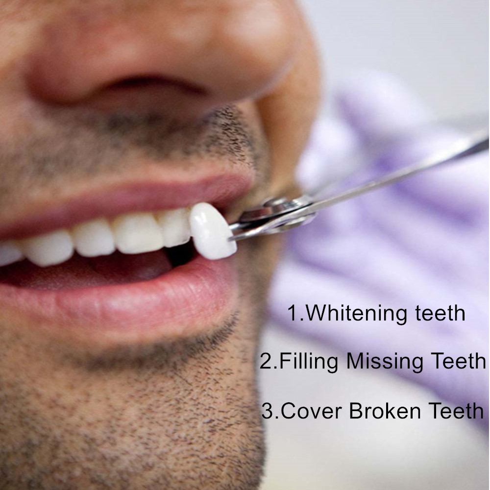 Temporres Aufsteckbares Perfektes Lcheln Zahnreparatur-Set fr Ober- und  Unterkiefer Knstliche Zhne Abdeckung Veneers Zahnprothesen Zahnspangen  Instrumenten-Set| Alibaba.com