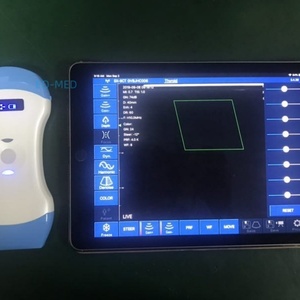 เครื่องสแกนอัลตราซาวนด์ไร้สาย 3-in-1 รุ่นมาตรฐานจริง รองรับ 5G IOS Android Windows สำหรับตรวจหัวใจ สูตินรีเวช หลอดเลือด และสัตว์ DCU19E - Product Image 5