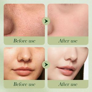SADOER - Loción Hidratante de Aguacate y Mascarilla <span class=keywords><strong>Facial</strong></span> Más Vendida, Reduce las Arrugas, el Acné, Aclara la <span class=keywords><strong>Piel</strong></span>, Repara la <span class=keywords><strong>Piel</strong></span>, Set de Cuidado de la <span class=keywords><strong>Piel</strong></span> - Product Image 6